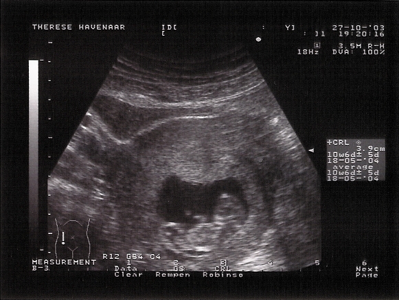 baby1.jpg